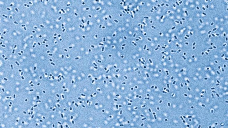 Электронно-микроскопическое изображение Pandoraea sputorum, патогена из микробиома легких Электронно-микроскопическое изображение Pandoraea sputorum, патогена из микробиома легких