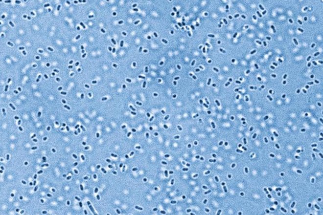 Электронно-микроскопическое изображение Pandoraea sputorum, патогена из микробиома легких Электронно-микроскопическое изображение Pandoraea sputorum, патогена из микробиома легких