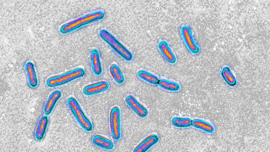 Под микроскопом Pseudomonas aeruginosa Под микроскопом Pseudomonas aeruginosa