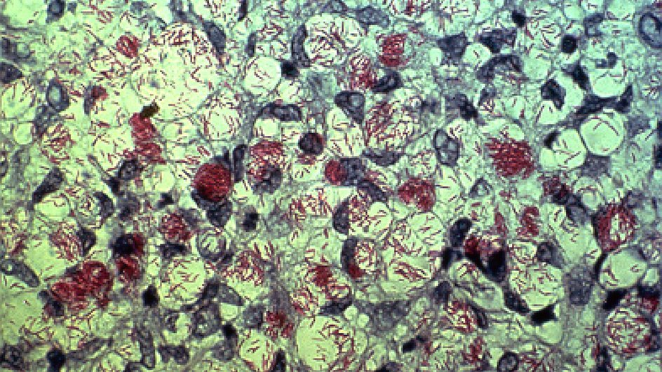 M. leprae