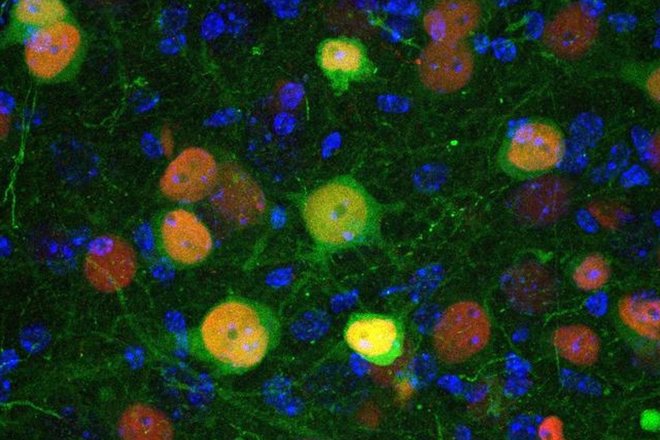 Конфокальное микроскопическое изображение, показывающее базолатеральные клетки миндалевидного тела, инфицированные вирусом, разработанным для внедрения белка рекомбиназы CRE (красным) и флуоресцентного белка GFP (зеленым), что позволяет визуализировать инф Конфокальное микроскопическое изображение, показывающее базолатеральные клетки миндалевидного тела, инфицированные вирусом, разработанным для внедрения белка рекомбиназы CRE (красным) и флуоресцентного белка GFP (зеленым), что позволяет визуализировать инф