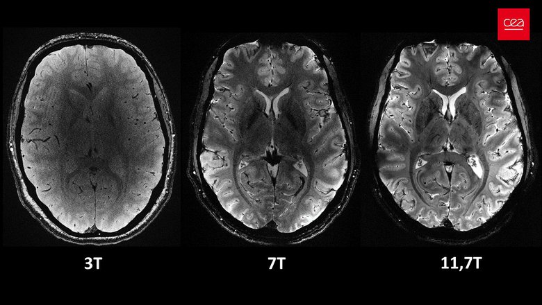 Снимок мозга, сделанный Iseult MRI