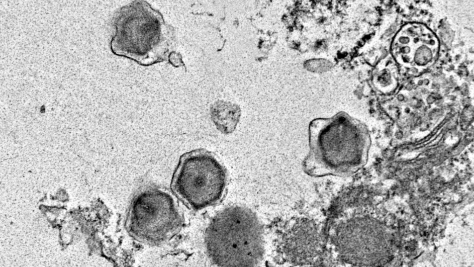 Гигантская вирусная инфекция одноклеточных водорослей Florenciella