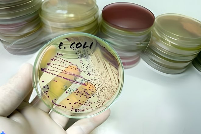 Визуализация бактерий E. coli Визуализация бактерий E. coli