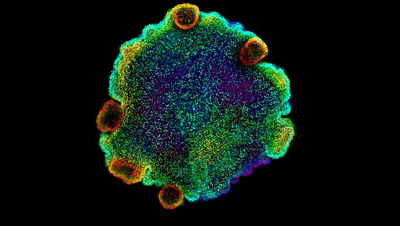 Микроскопическое изображение ядер одного из четырех видов плакозой.