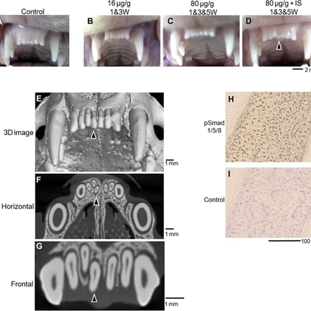 (A - D) Верхнечелюстные резцы хорьков при различных дозах нейтрализующего антитела USAG-1. (E - G) Микротомография. Иммунолокализация фосфорилированного Smad1/5/8 в сверхнормативных зубах. Наконечники стрелок указывают на полученные сверхнормативные зубы.