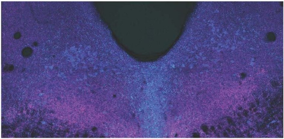 Область дорсального шва головного мозга, полученная с помощью конфокальной микроскопии