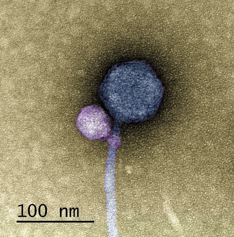 Изображение вируса на трансмиссионном электронном микроскопе. Фото: Tagide deCarvalho