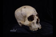 Череп и нижняя челюсть 236, датируемые 2687–2345 годами до нашей эры, принадлежали мужчине в возрасте от 30 до 35 лет.