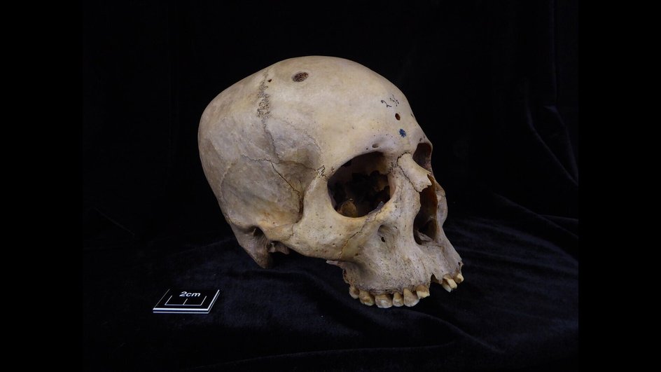 Череп и нижняя челюсть 236 принадлежали мужчине в возрасте от 30 до 35 лет.