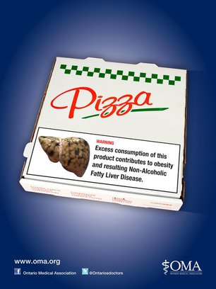 Slide image for gallery: 2334 | Канадские медики считают: пицца крайне вредная для печени