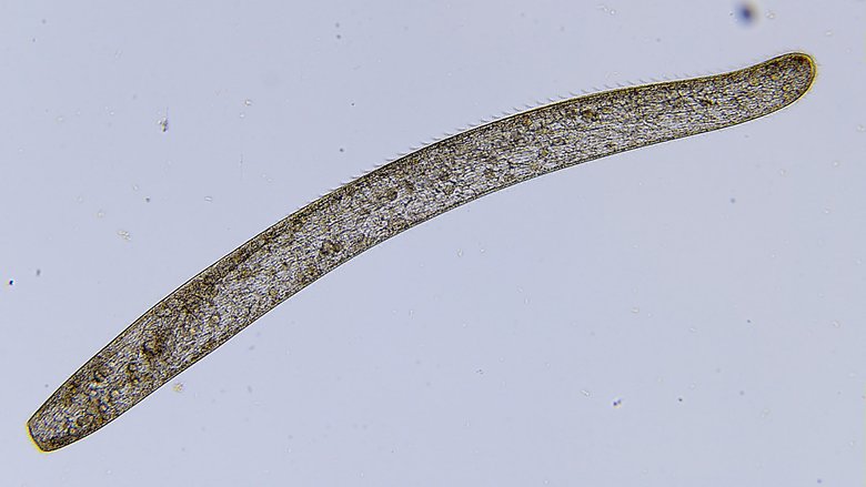 Spirostomum Ambiguum. Фото: Wikipedia