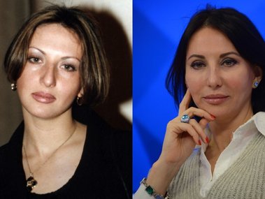 Slide image for gallery: 11753 | Алика Смехова в 2000 году (слева) и в 2018 году (справа)