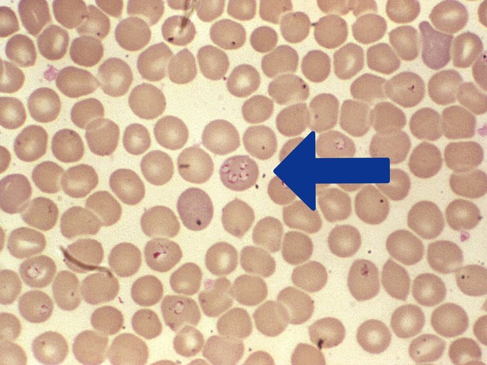 Простейшие рода Babesia Простейшие рода Babesia