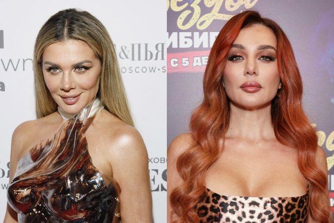 Анна Седокова до и после пластики Анна Седокова до и после пластики