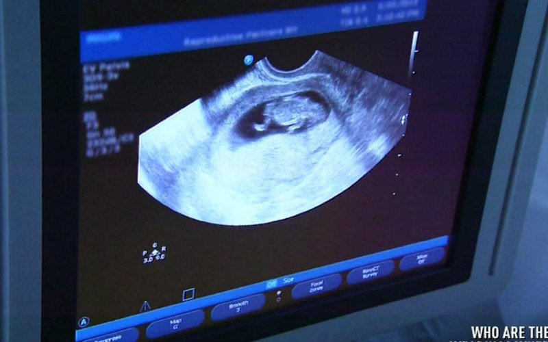 7 недель видео. УЗИ на 8 неделе беременности в мониторе. УЗИ 9.5 недель беременности. Снимки УЗИ беременности.