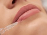 введение филлера в губы введение филлера в губы