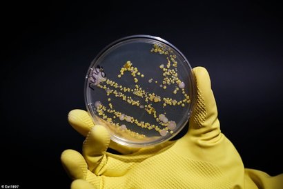 Визуализация загрязнения колец и колонии бактерий, обнаруженных на них