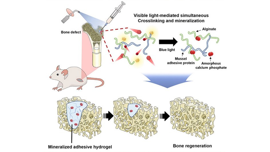 Как гидрогель восполняет дефицит костной ткани у крыс
