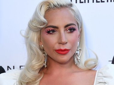 Slide image for gallery: 10643 | Леди Гага, 33 года. По Голливуду ходят слухи, что Гага значительно поработала над собой перед премией «Оскар» в этом году, не только активно занявшись спортом, но пройдя через серию омолаживающих уколов.