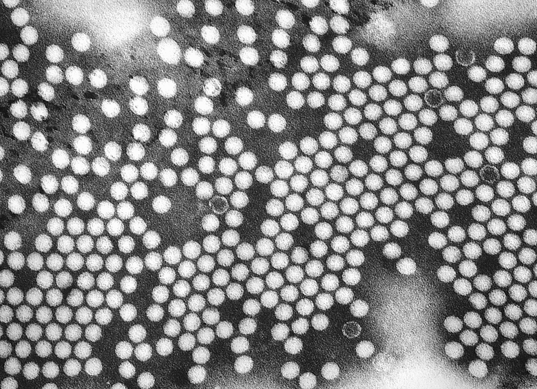 Как выглядит вирус полиомиелита. Фото: Wikimedia / CDC/ Dr. Fred Murphy, Sylvia Whitfield