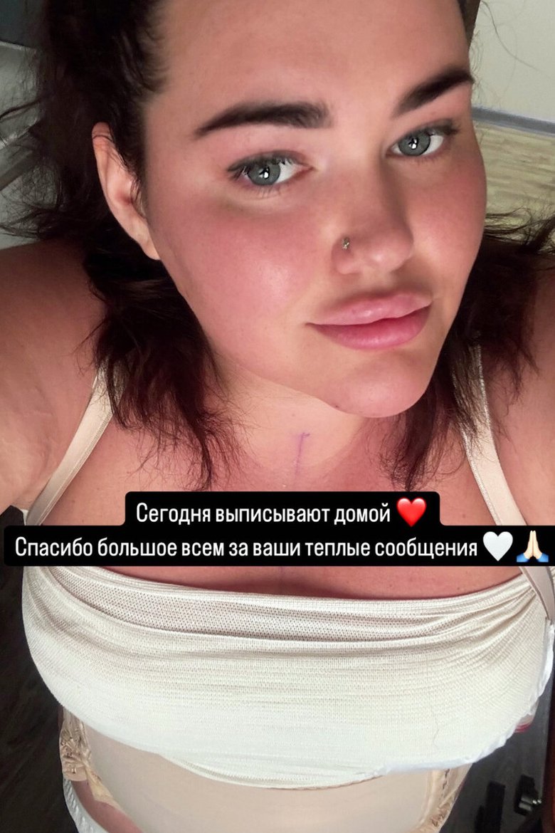 Дочь Иосифа Пригожина вновь сделала пластику Дочь Иосифа Пригожина вновь сделала пластику