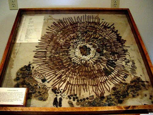 1440 вещей, найденных в желудке человека, страдающего пикацизмом / Wikimedia
