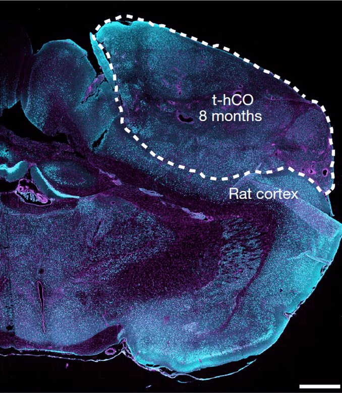 Трансплантат коры головного мозга человека (t-hCO) в мозгу крысы / Фото: Nature