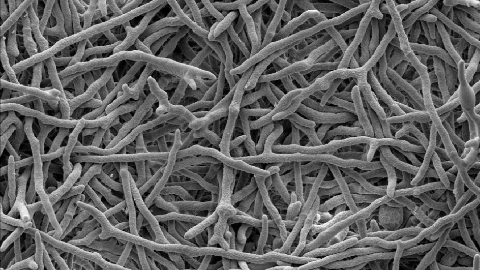 Микрофотография гриба Trichoderma reesei Микрофотография гриба Trichoderma reesei