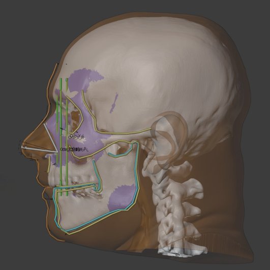 3D-визуализация черепа Аменхотепа III.
