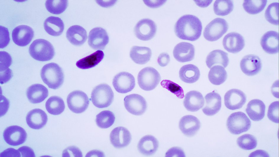 Паразит Plasmodium falciparum