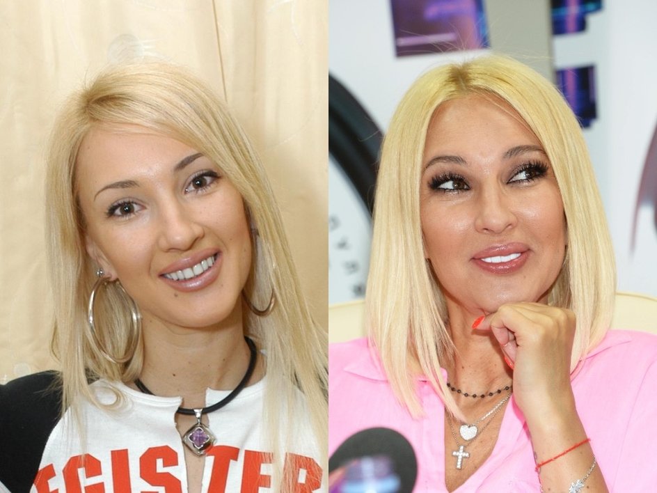 Лера Кудрявцева ресницы