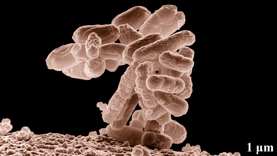 E. coli под микроскопом E. coli под микроскопом