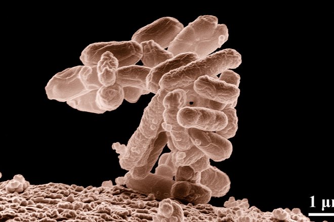 E.coli