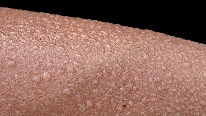 Человеческая кожа состоит из нескольких слоев разной плотности и толщины, не только обеспечивая защиту от механических воздействий, но и регулируя температуру, потоотделение, передавая тактильную информацию, проявляя гидрофильные и гидрофобные свойства в зависимости от ситуации и многое другое