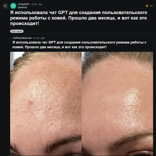 Девушка поделилась в Reddit результатами использования ИИ Девушка поделилась в Reddit результатами использования ИИ