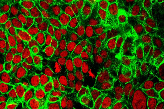 NCI Cells NCI Cells