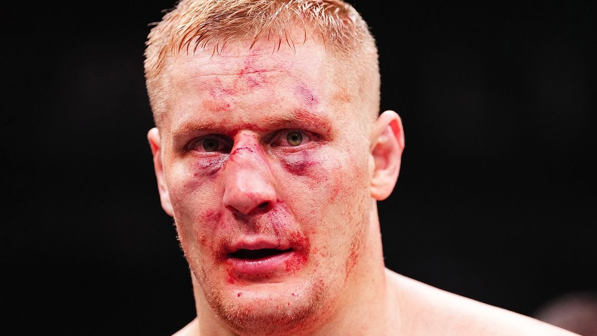 Русский боец UFC Павлович перенес операцию — известны сроки возвращения в октагон