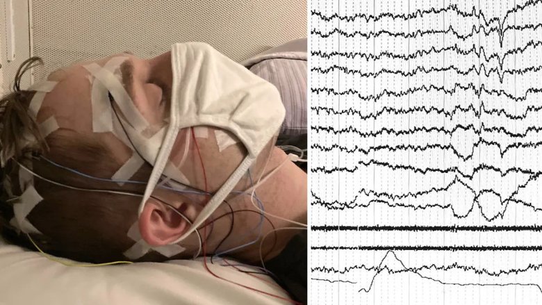 Электрические сигналы от мозга спящего отображаются на мониторе. Фото: K Konkoly