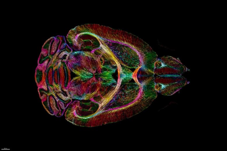 Цвета отображают нейронные связи и то, как они меняются с течением времени. Фото: Duke Center for In Vivo Microscopy