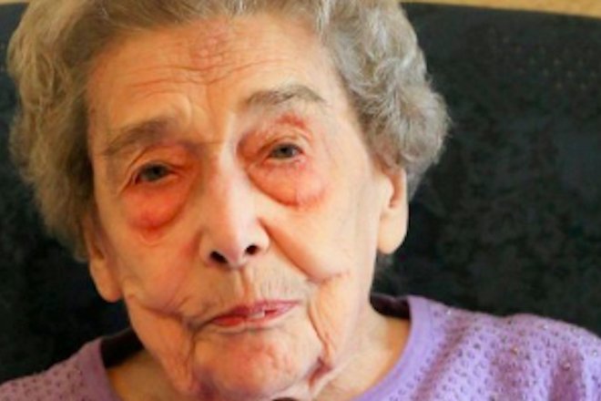 106-летняя британка объяснила долголетие полным отказом от мужчин 106-летняя британка объяснила долголетие полным отказом от мужчин