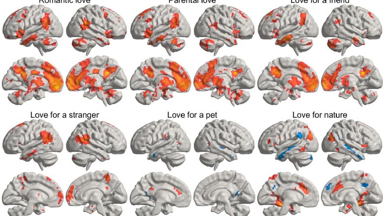 Иллюстрация показывает, как разные типы любви активируют разные области мозга.