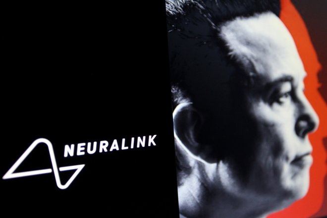 Neuralink