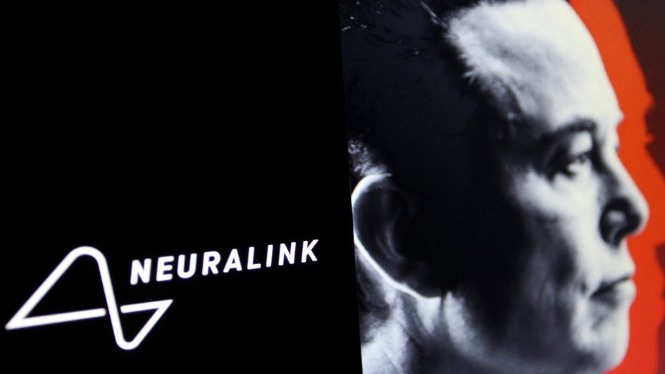 Neuralink