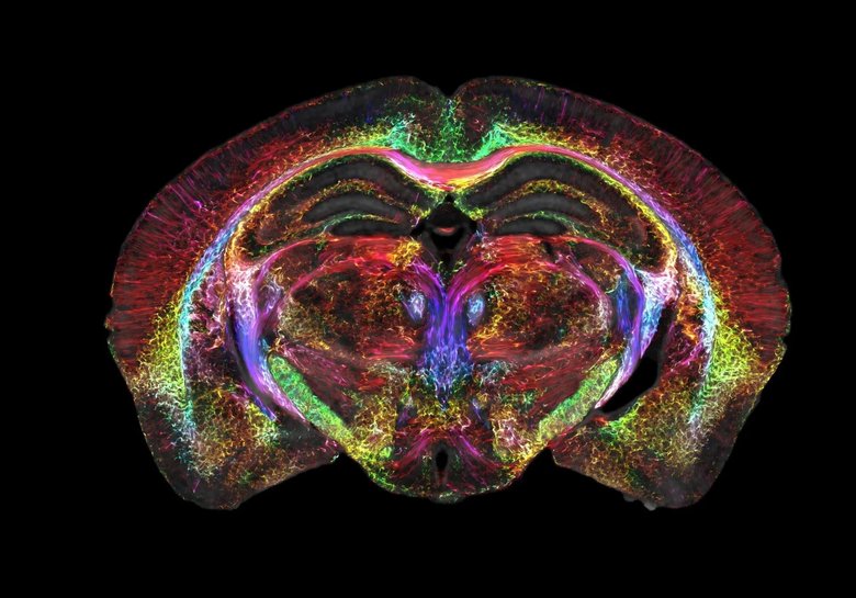 МРТ и световая микроскопия позволили по-новому заглянуть внутрь головы мыши. Фото: Duke Center for In Vivo Microscopy