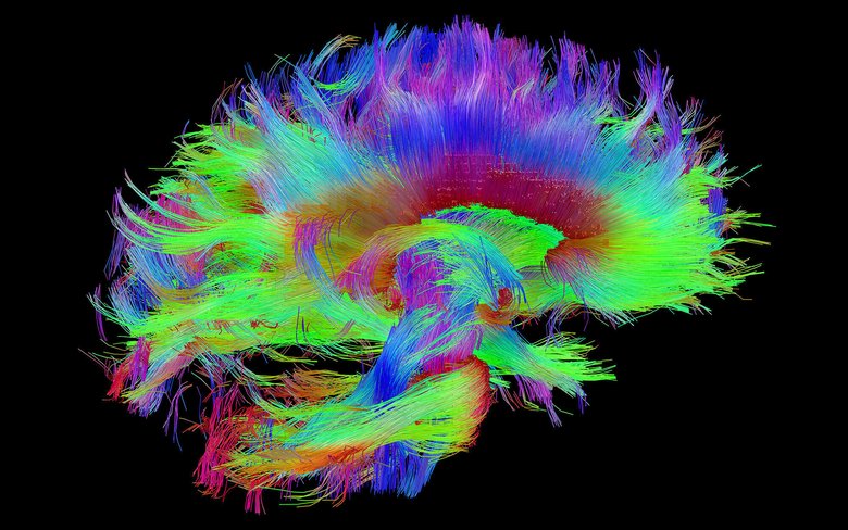 Очень подробная «схема соединений» человеческого мозга. Фото: Human Connectome Project