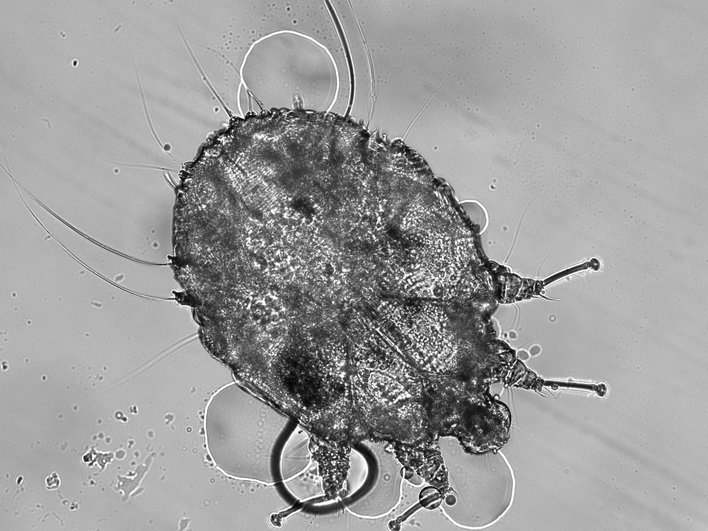 Чесоточный клещ Sarcoptes scabiei Чесоточный клещ Sarcoptes scabiei