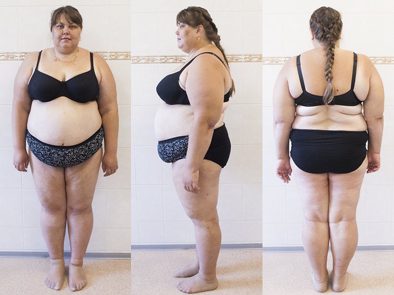 Юлия очень хочет снизить вес, чтобы снова вернуться к активному образу жизни