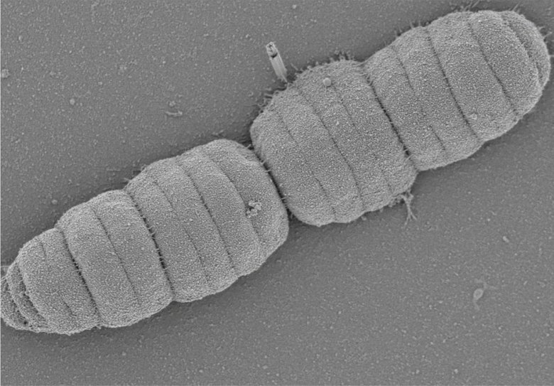 Так выглядит Conchiformibius steedae в микроскопе. Фото: Nature