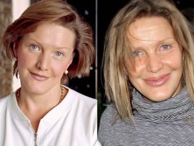 Slide image for gallery: 13424 | Елена Проклова в 2002 году (слева) и в 2017 году (справа)